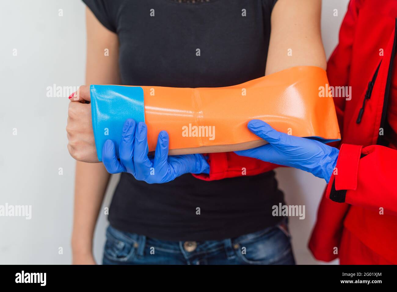 Broken wrist and arm in blue plaster cast hires stock photography and