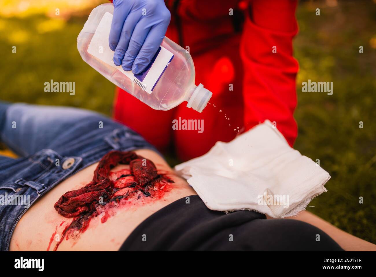 The process of treating the wound with an antiseptic. Knee injury. Close-up. First aid training Stock Photo