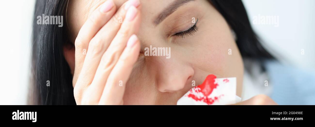 Headache and on sale bloody nose