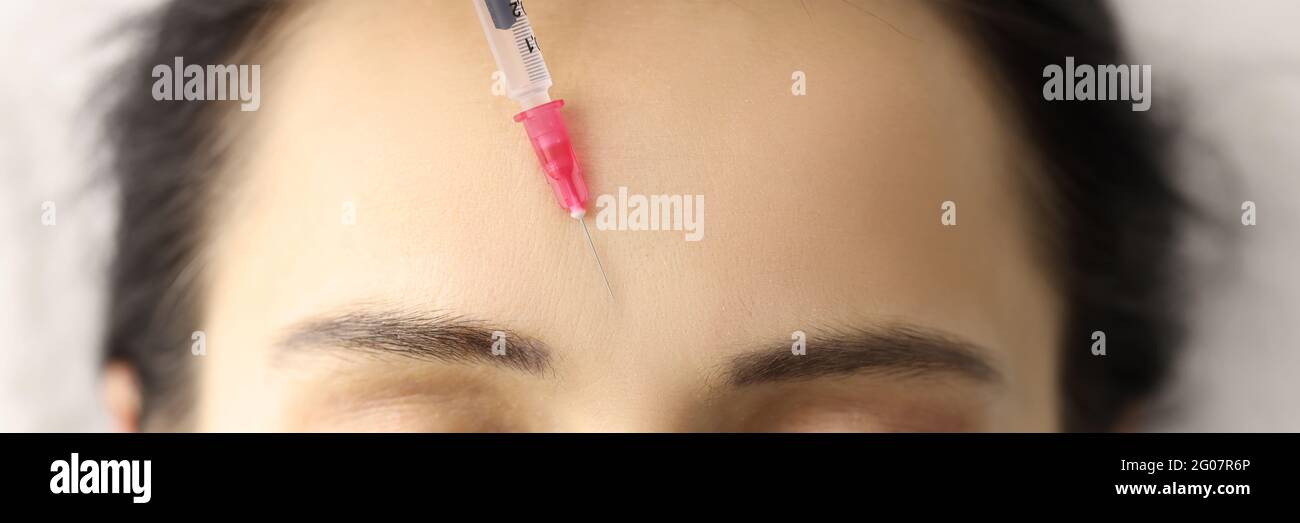 Cosmetic injection is given to forehead of young woman closeup Stock Photo