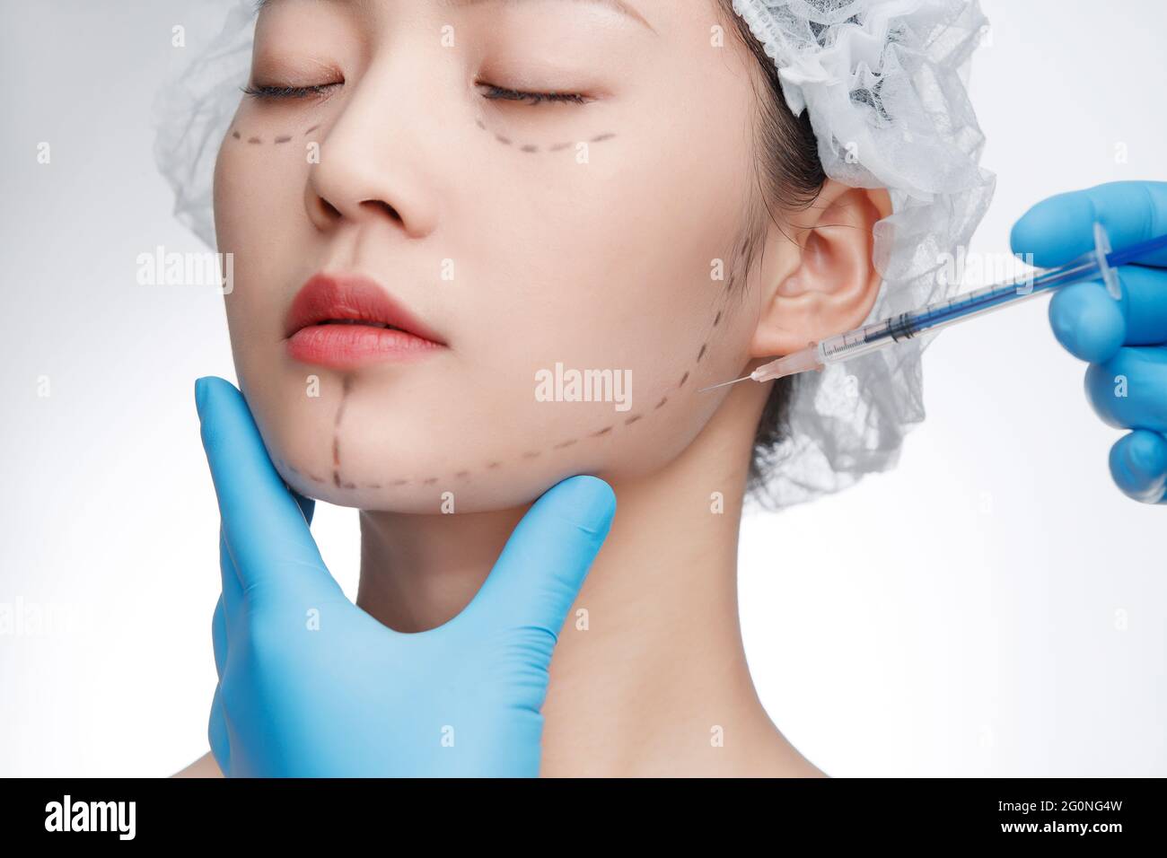 Injection on skin line hi-res stock photography and images - Alamy