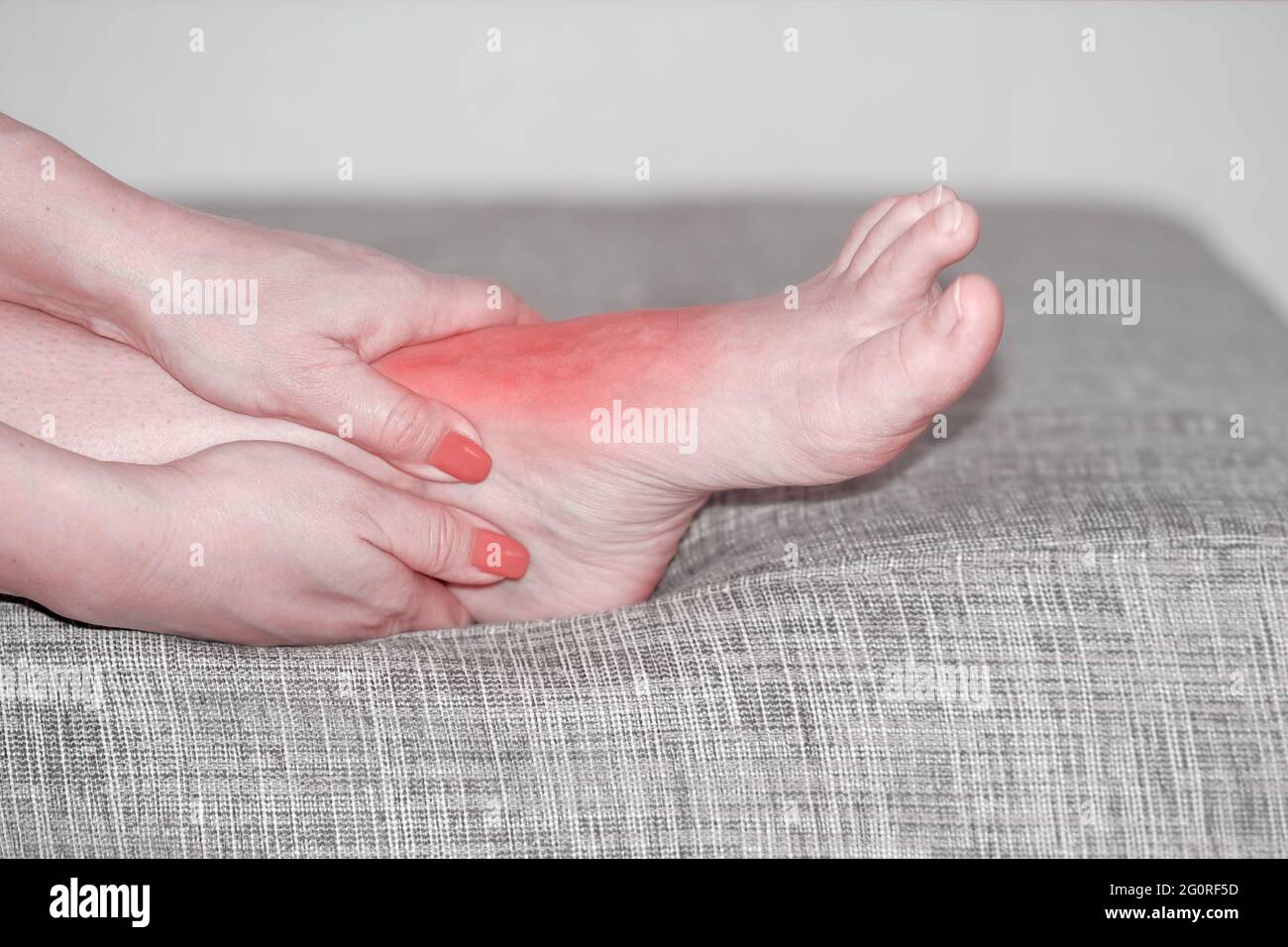 Sprain, dislocation of the foot. Leg joint injury, red inflamed spot. Medical treatment. Sports injury Stock Photo
