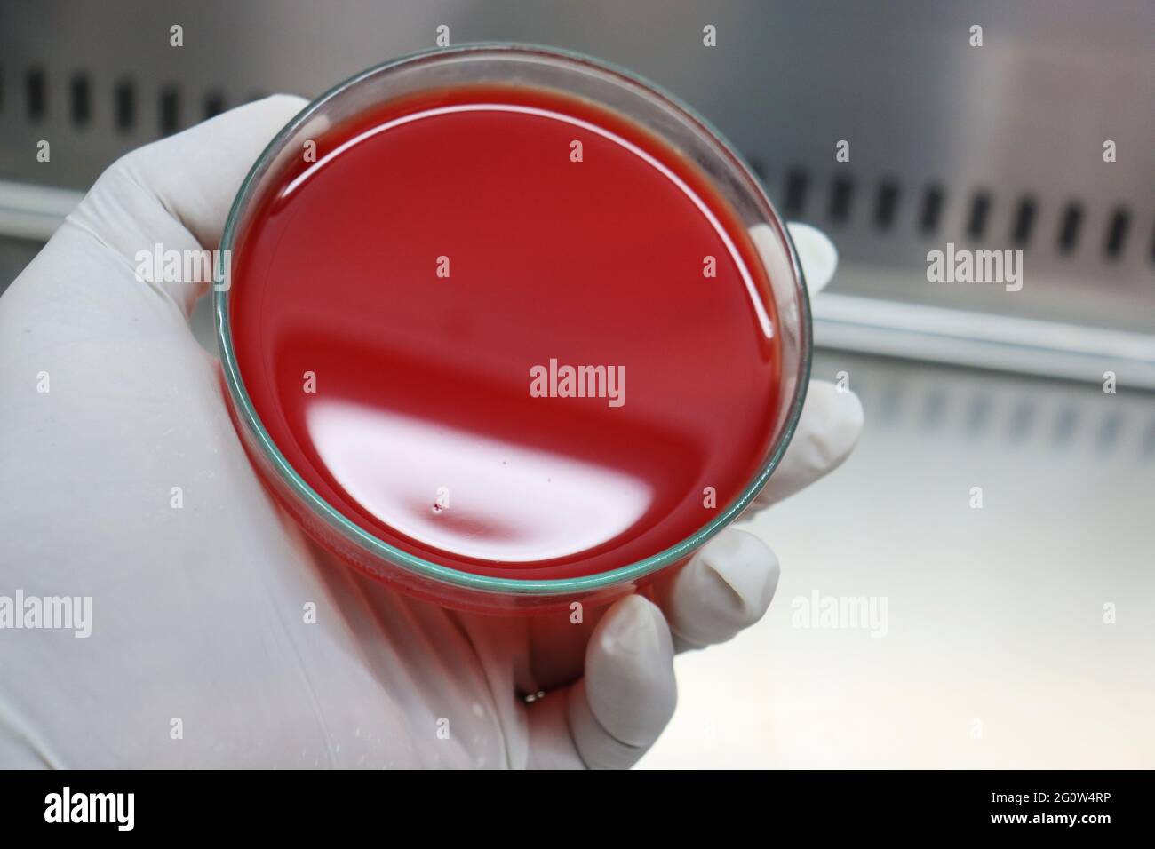 Blood agar hires stock photography and images Alamy
