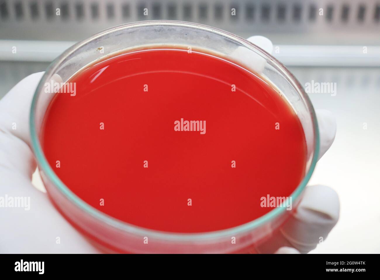 Blood agar hires stock photography and images Alamy