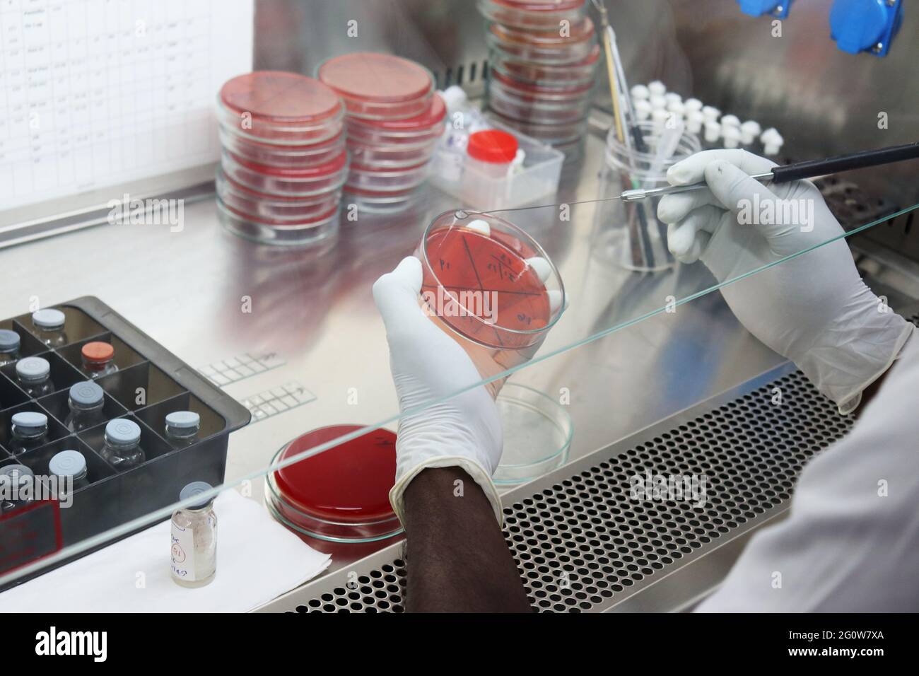 MacConkey agar is a selective and differential culture medium for