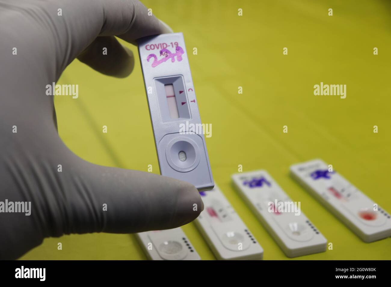 Rapid diagnostic tests detect the presence of viral proteins (antigens