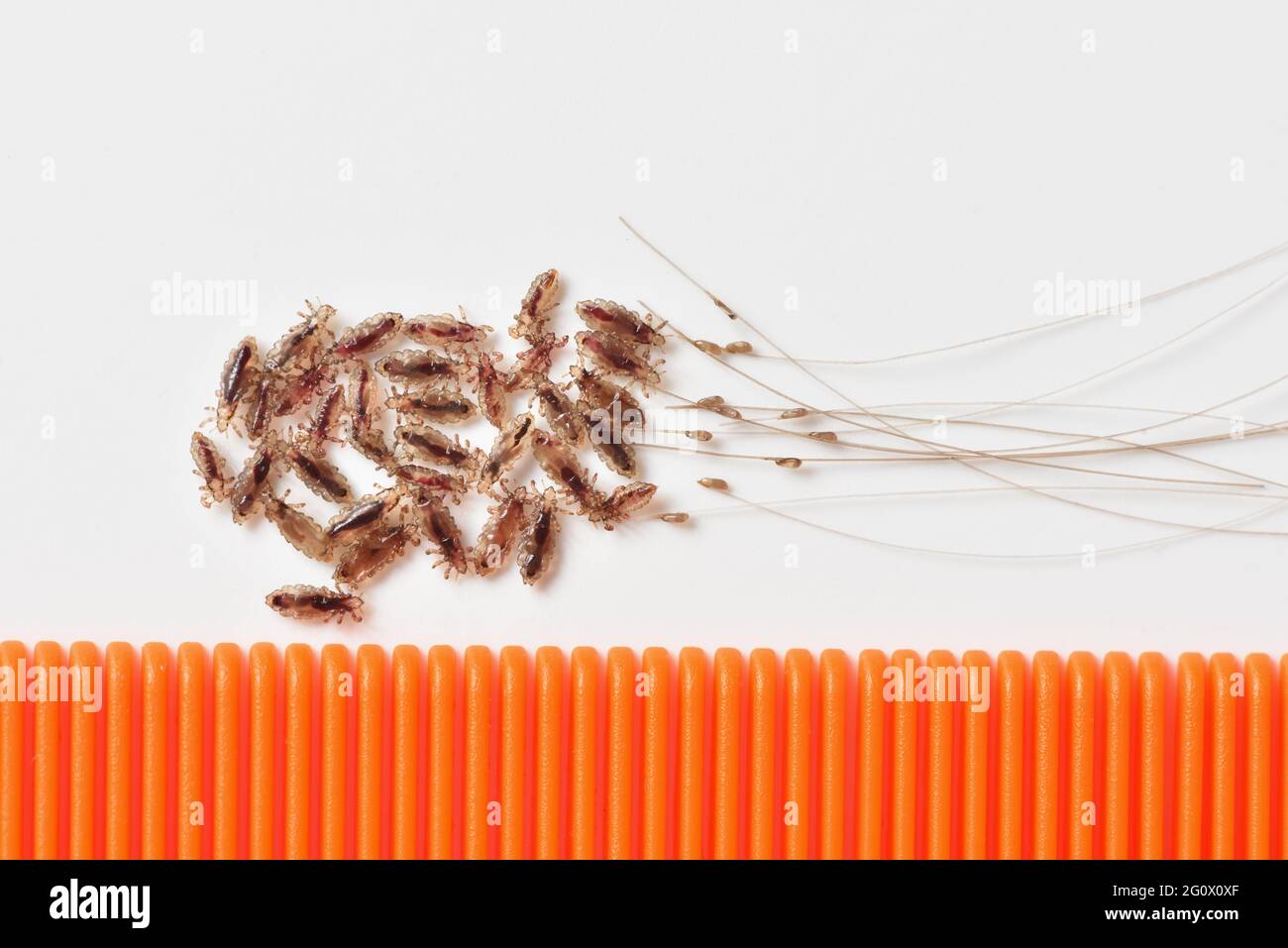 Head lice eggs hi-res stock photography and images - Alamy