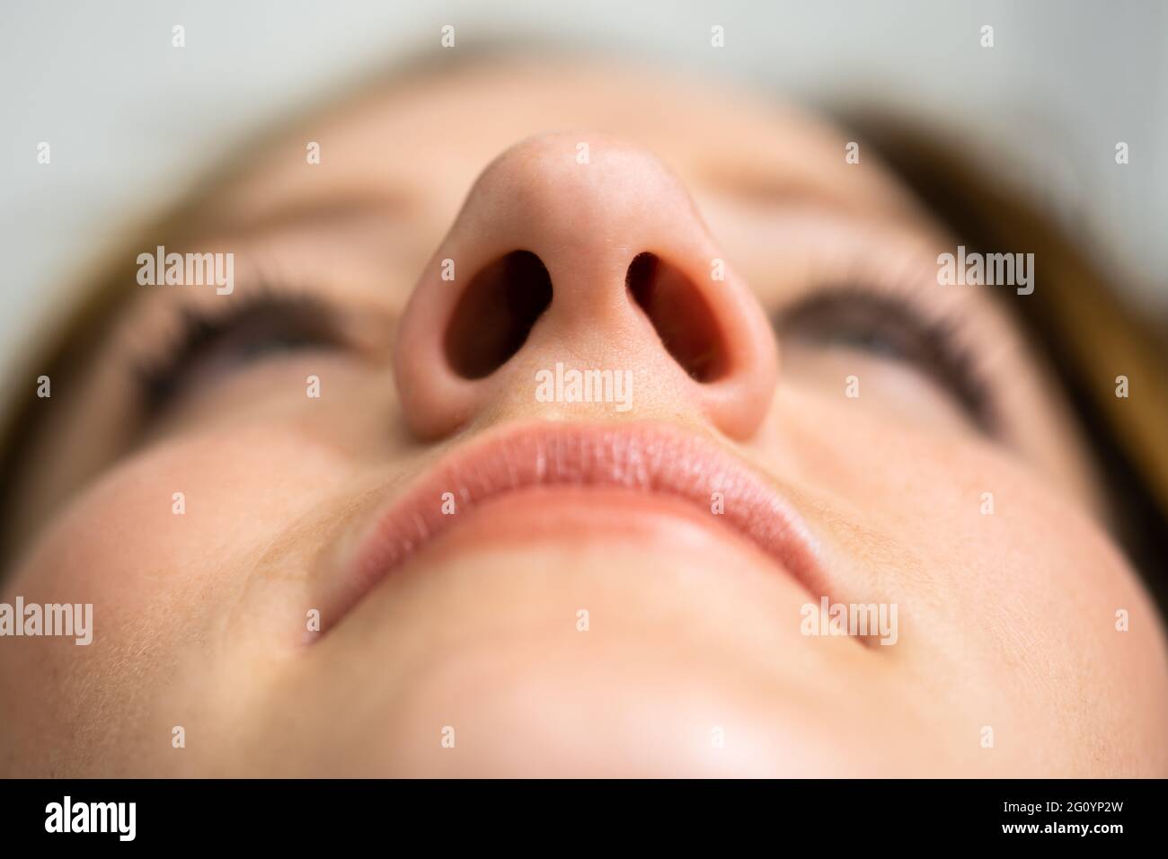 Young Woman After Aesthetic Facelift. Rhinoplasty Nose Surgery Stock Photo