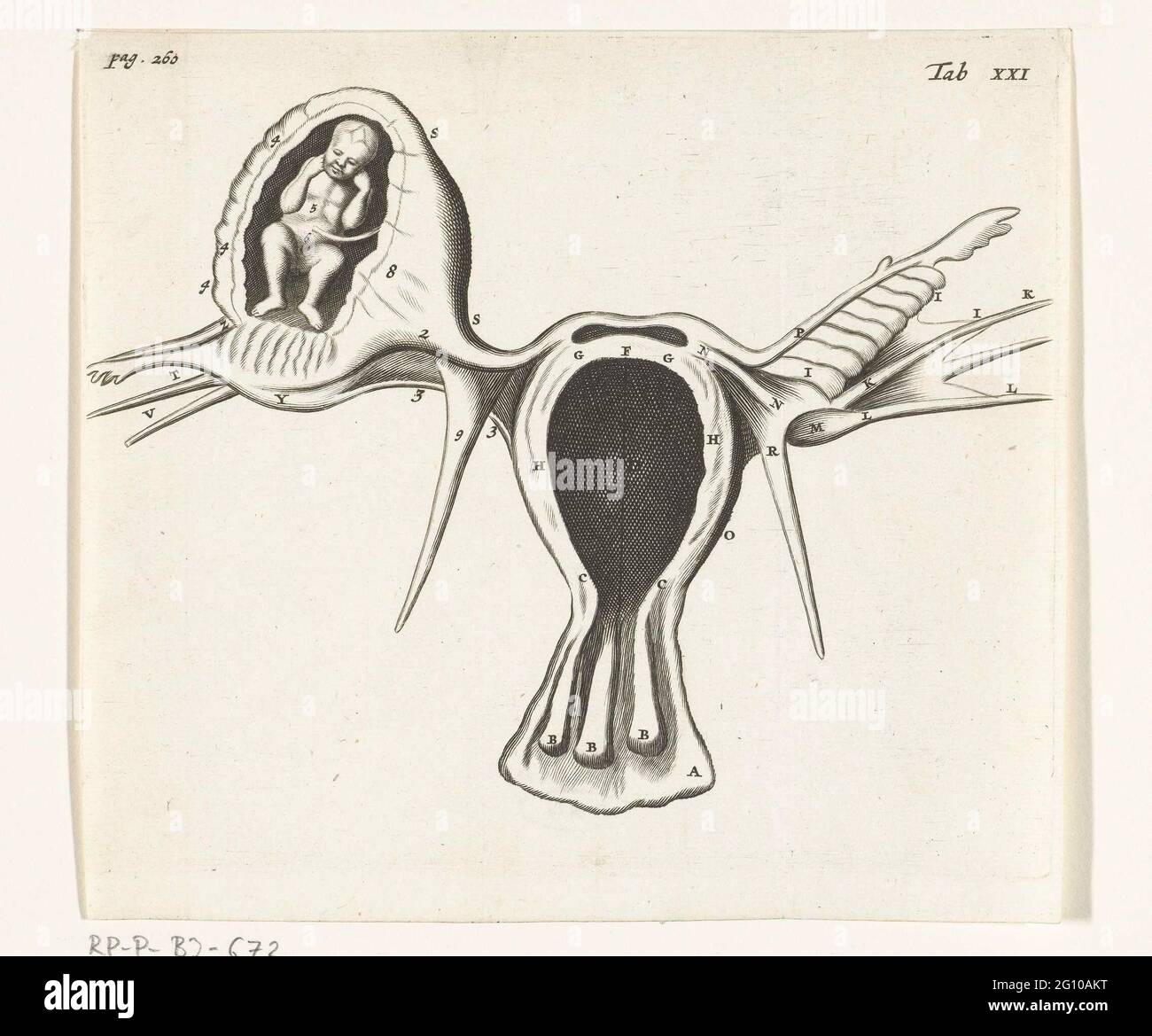 Anatomical depiction of an ectopic pregnancy. In 1672 physician and anatomist Reinier de Graaf published De mulierum organis, a book about the organs of the female body, with prints by Hendrik Bary. De Graaf was the first to conclude that a foetus grows from the mother’s egg cell after it is fertilised by the father’s seed. He also discusses anomalies such as ectopic pregnancies (when the fertilised egg implants outside the womb). Stock Photo