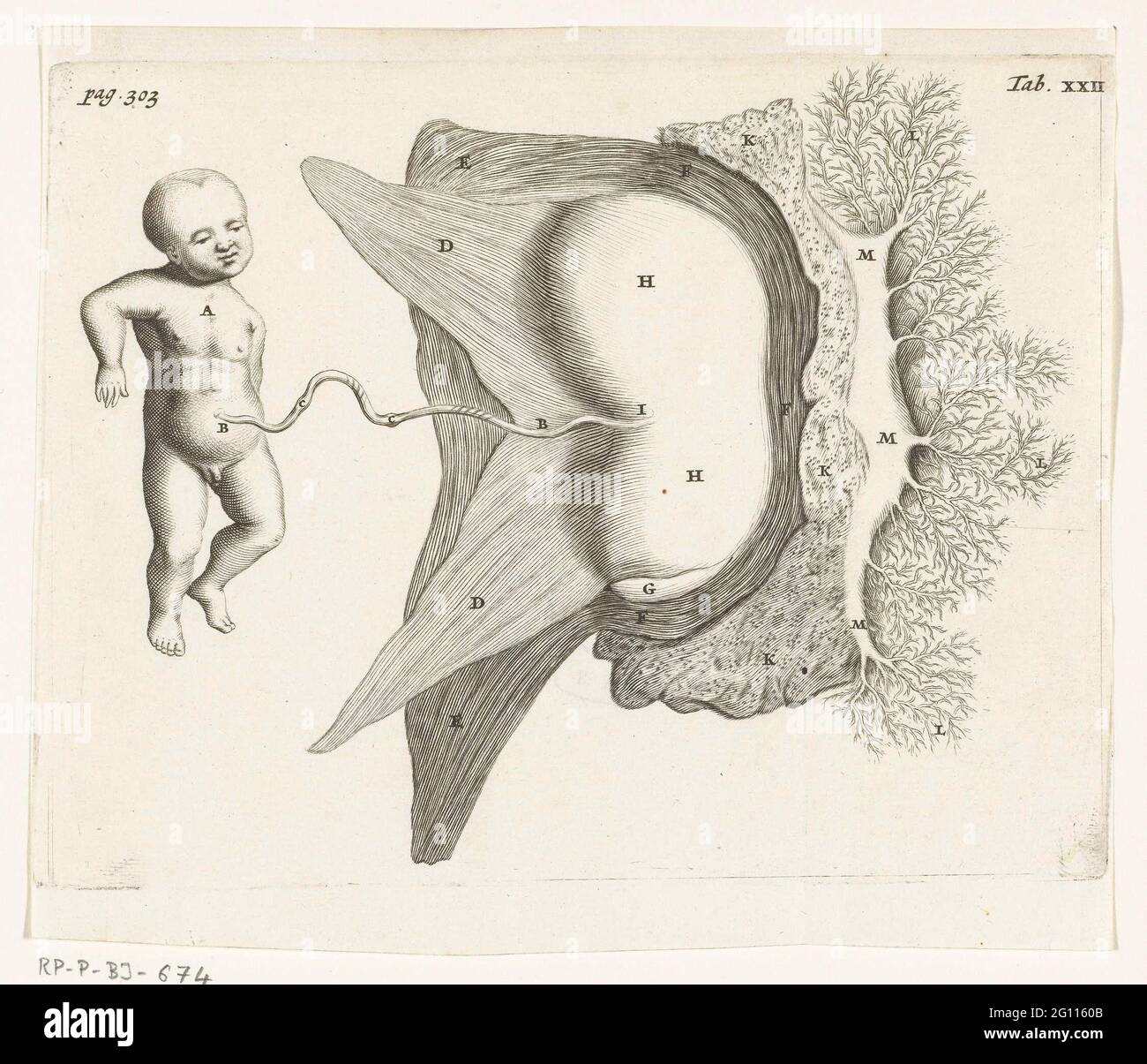 A foetus attached by the placenta to the womb. In 1672, physician and anatomist Reinier de Graaf published his De mulierum organis about the female reproductive organs, with prints by Hendrik Bary. De Graaf was the first to conclude that a foetus was the product not just of a man’s seed, but also of a woman’s egg. He discovered what he called blisters, which later became known as Graafian follicles. Stock Photo