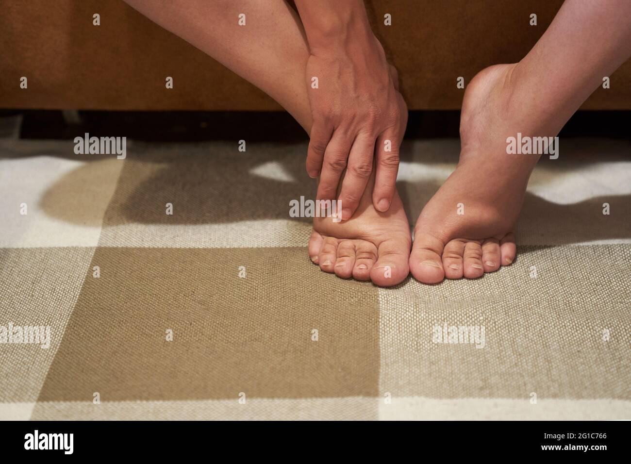 Woman with swelling on the legs, tired and pain in the legs, swelling