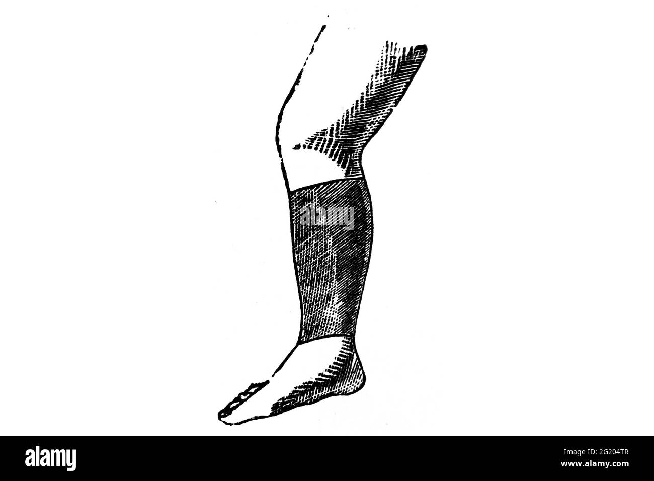 Compression socks for varicose veins, illustration - Stock Image