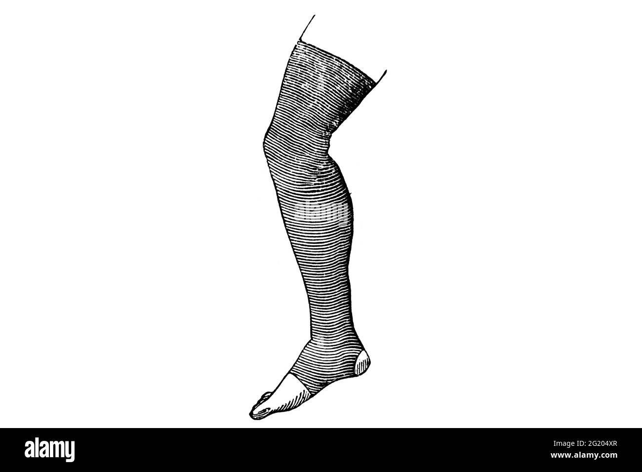 Compression Stockings for Varicose Veins – 1897 Original Vintage ...