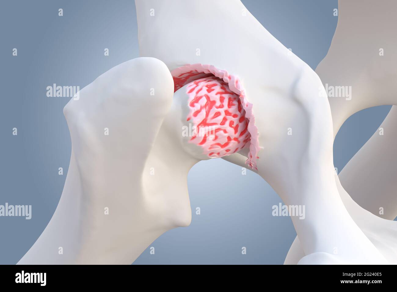 Picture of Canine Arthritis and Osteoarthritis joint inflammation, deterioration ...