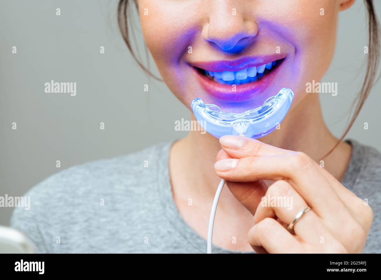 lv light for braces