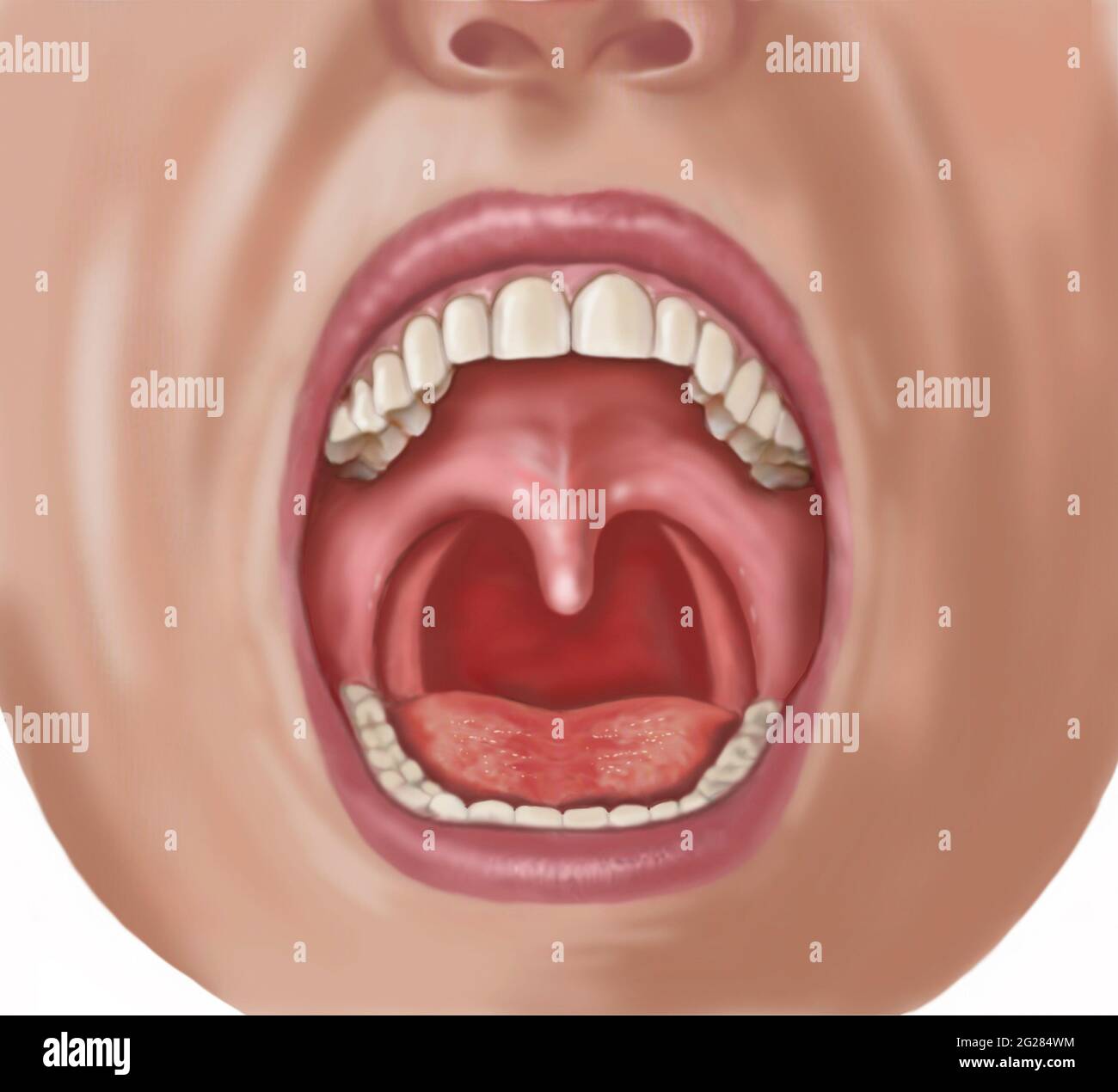Looking into open mouth showing uvula, teeth, tongue and pharynx. Stock Photo