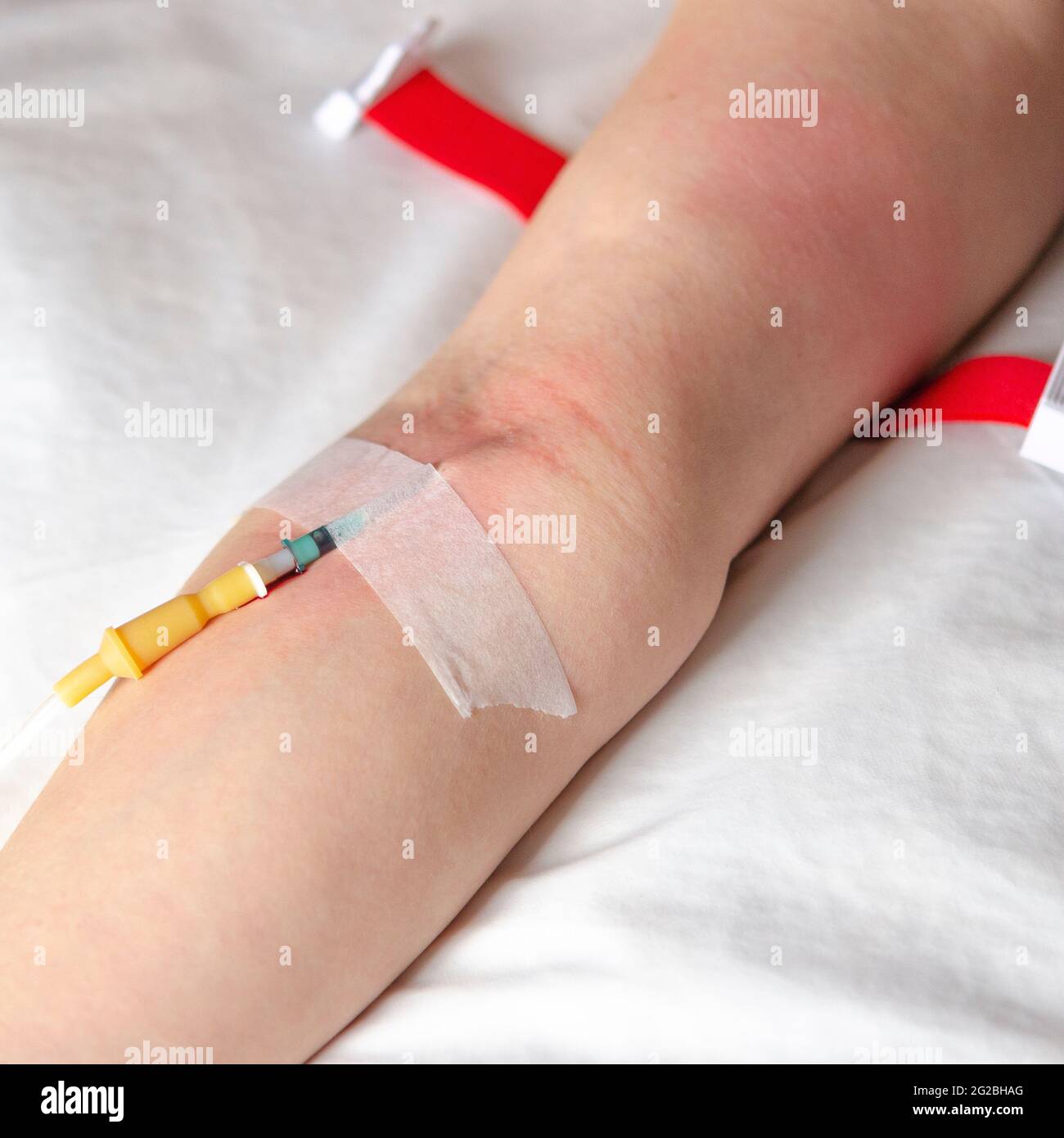Intravenous drip in the hospital emergency room for first aid. health ...