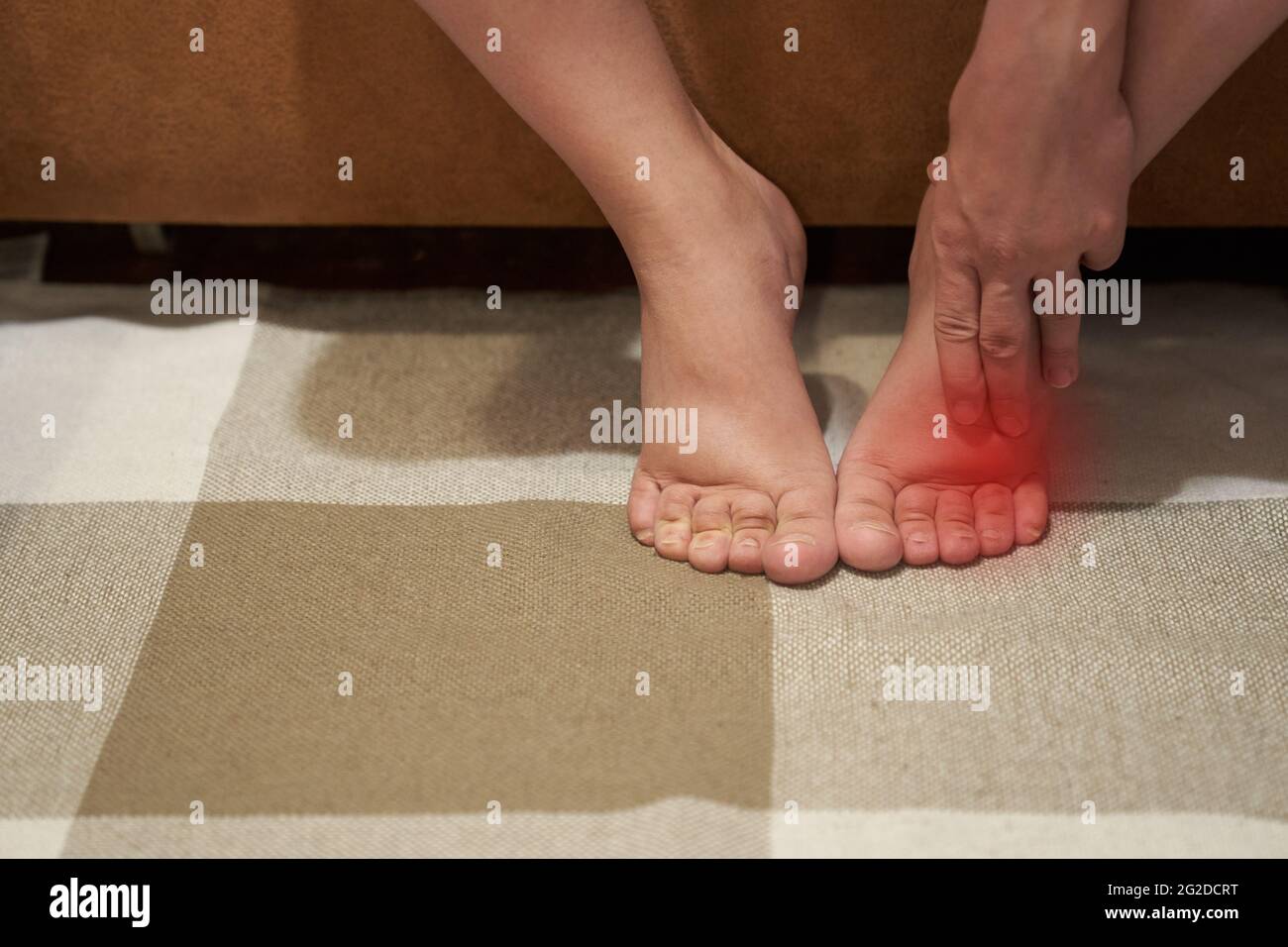 Woman with swelling on the legs, tired and pain in the legs, swelling