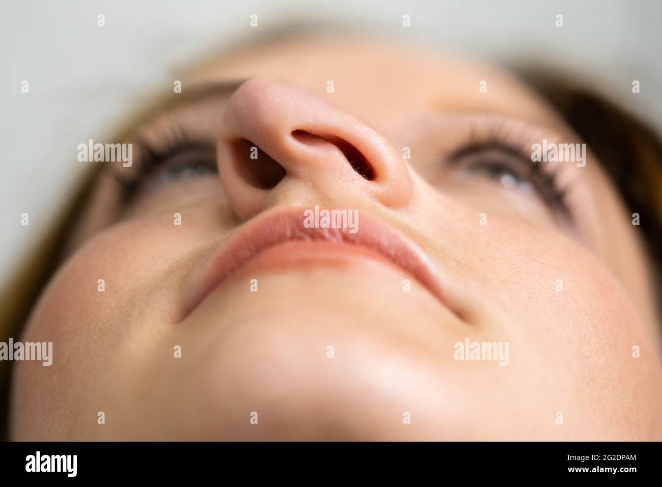 Young Woman Before Aesthetic Facelift. Rhinoplasty Nose Surgery Stock Photo