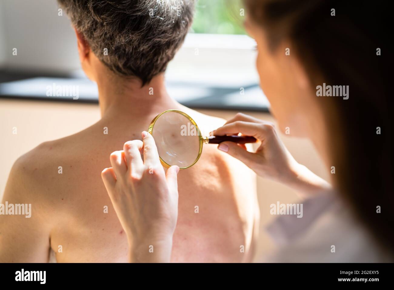 Dermatologist Checking Skin Allergy And Pigment Problems Stock Photo