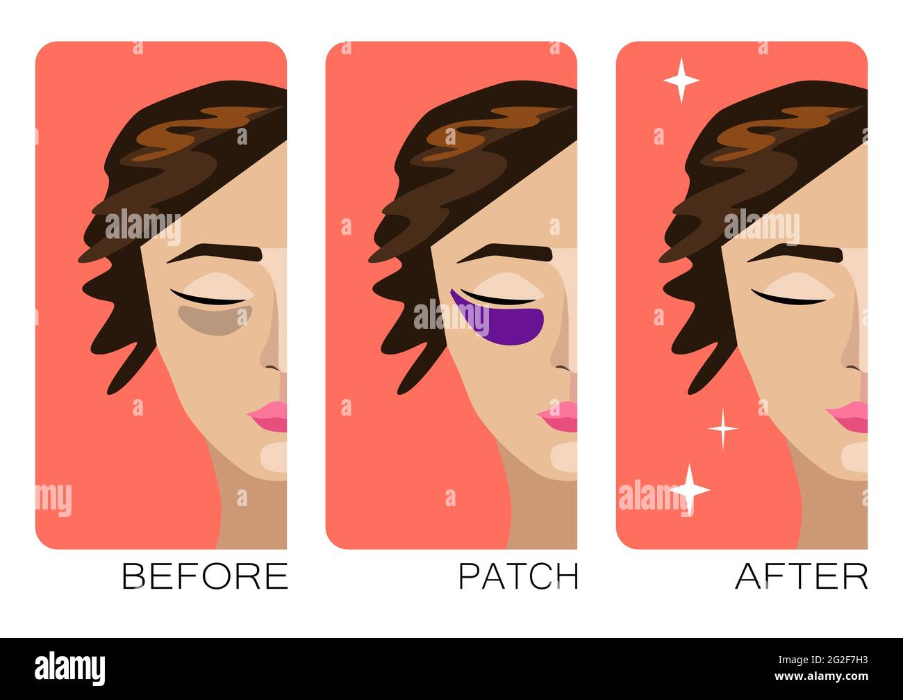 Bags under eyes woman Stock Vector Images Alamy