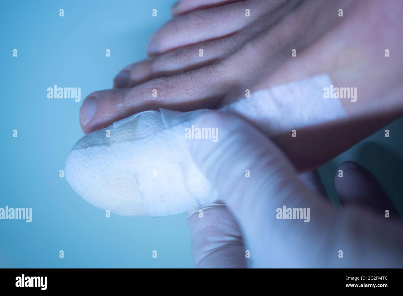 Foot big toe bandage injured feet in medical clinic hospital center