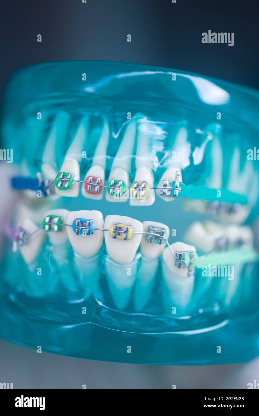 Dental teeth aligner bracket teaching student model showing gums and