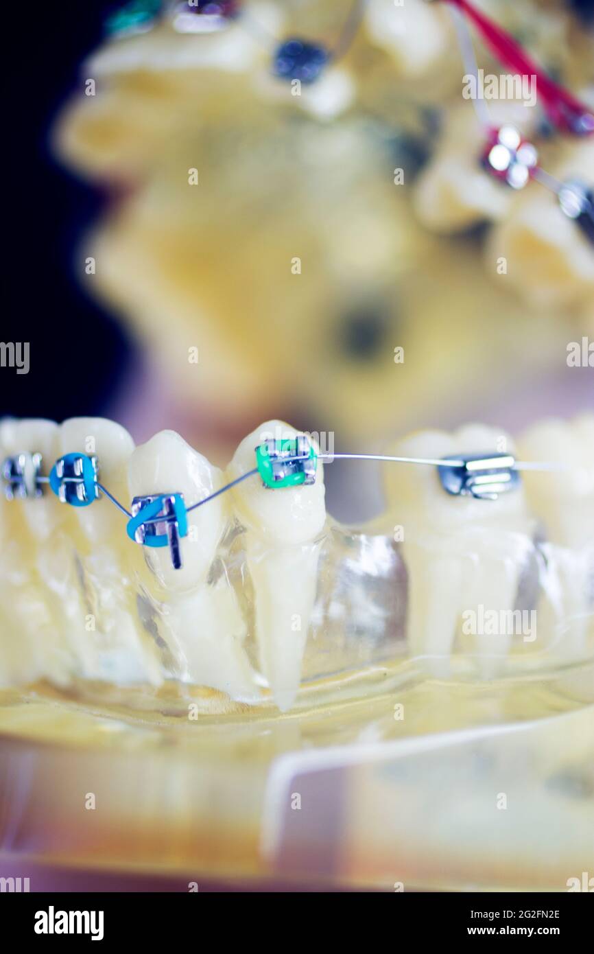 Dental teeth aligner bracket teaching student model showing gums and