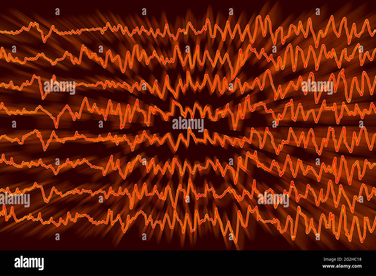 Brain waves in migraine, illustration Stock Photo