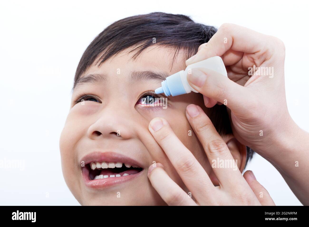 Closeup of parent pouring eye drops in eye her son (conjunctivitis