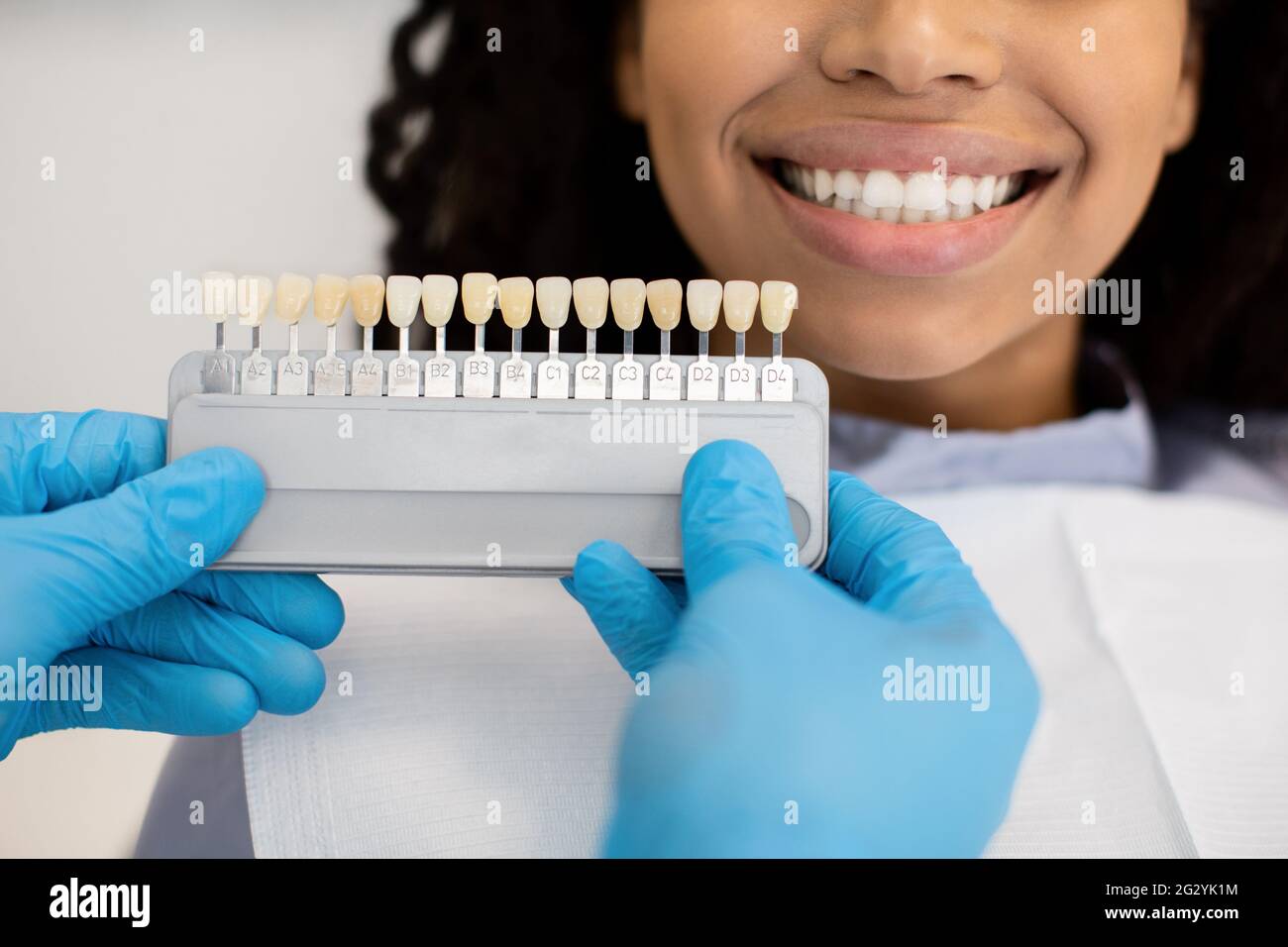 Teeth Colour Shade Chart at Dominic Penland blog