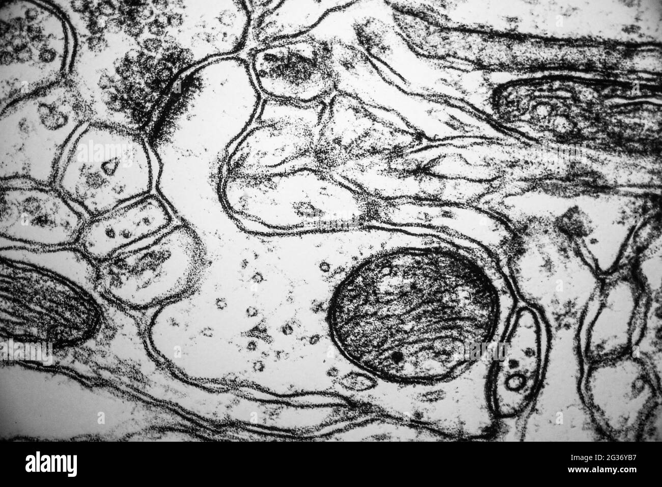 Electron micrograph of a dendritic spine. Brain exhibition Inside MIT Museum Building at 265 Massachusetts Avenue Cambridge, Boston Massachusetts. USA Stock Photo