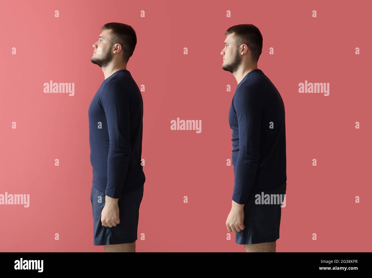 Young man with bad and proper posture on color background Stock Photo -  Alamy