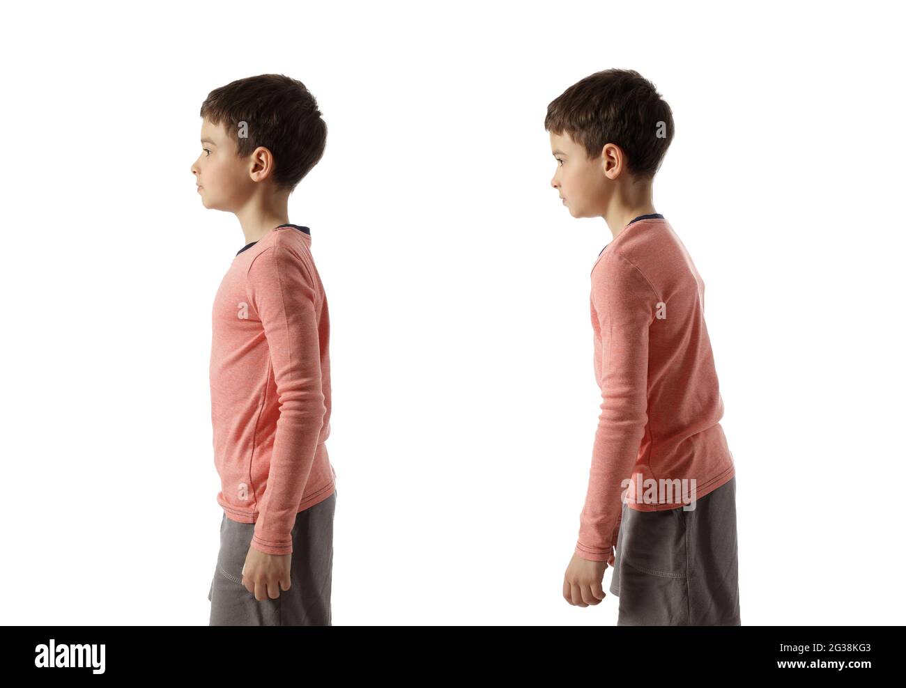 Little boy with proper and bad posture on white background Stock Photo
