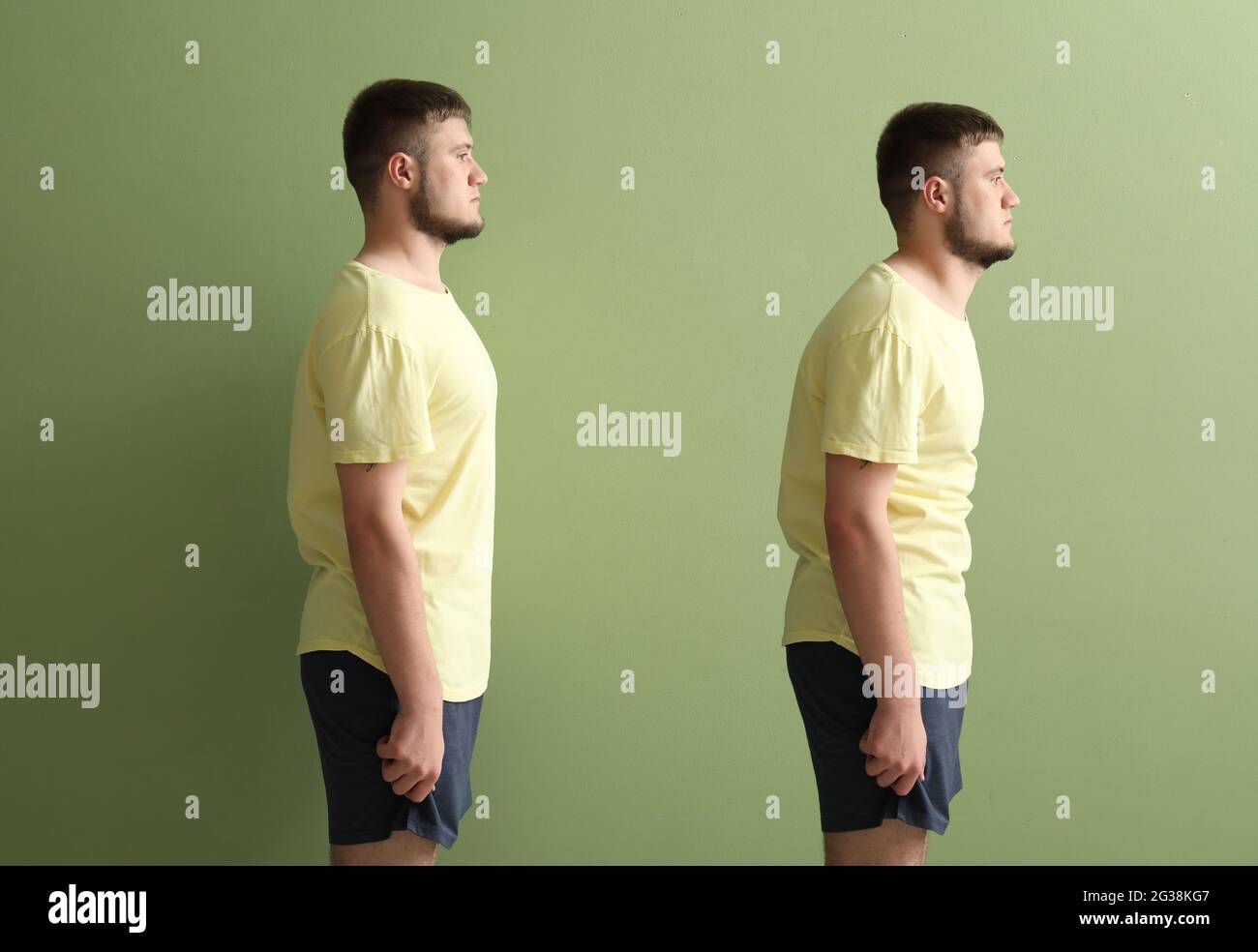 https://c8.alamy.com/comp/2G38KG7/young-man-with-bad-and-proper-posture-on-color-background-2G38KG7.jpg