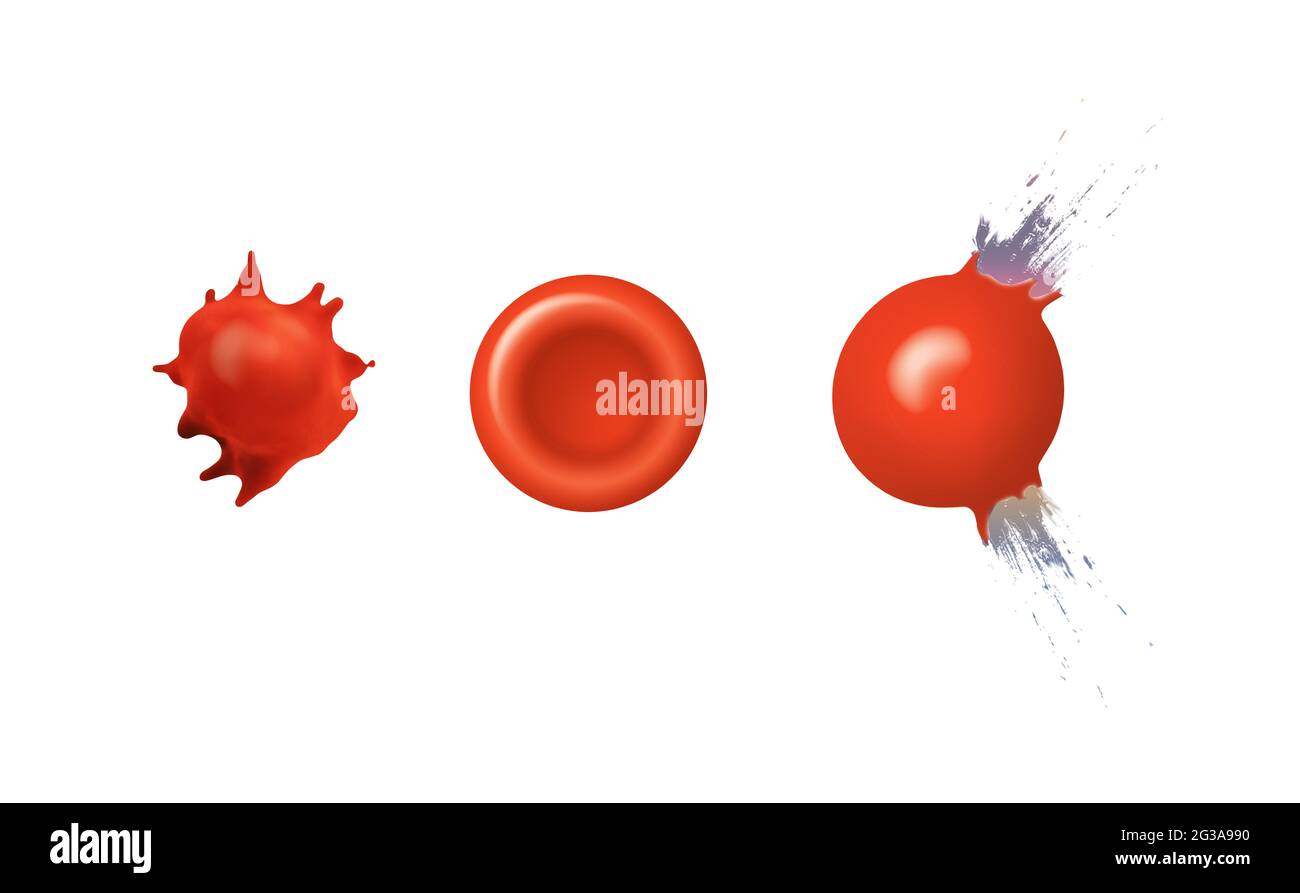 Osmosis in Animal red cell. Red blood cells lose water and shrink in a concentrated solution. They swell and burst in a solution that is too dilute Stock Photo