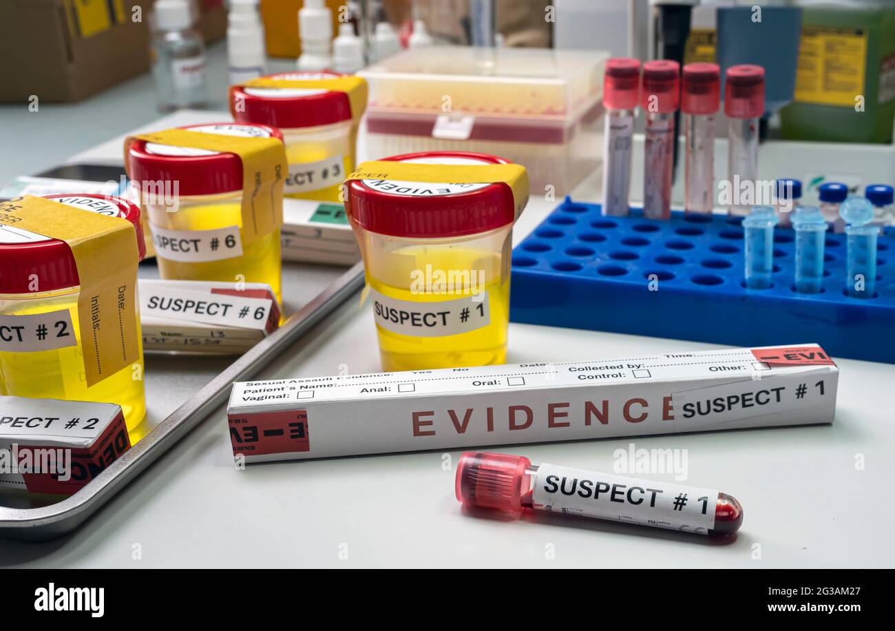 Various analyses of urine, saliva and blood of homicide suspects in crime lab, conceptual image. Stock Photo