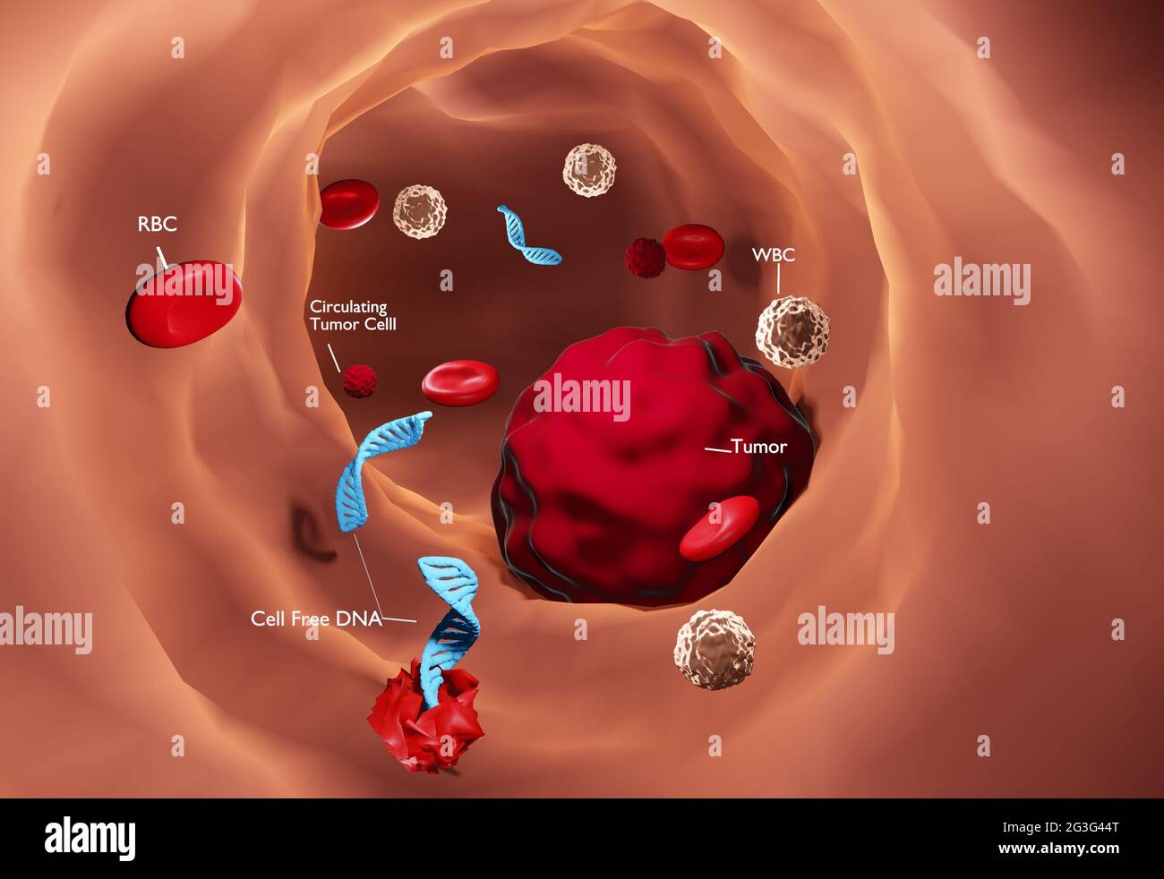 3D Illustration of tumour cells releasing the tumour cell free DNA into the blood stream. Stock Photo