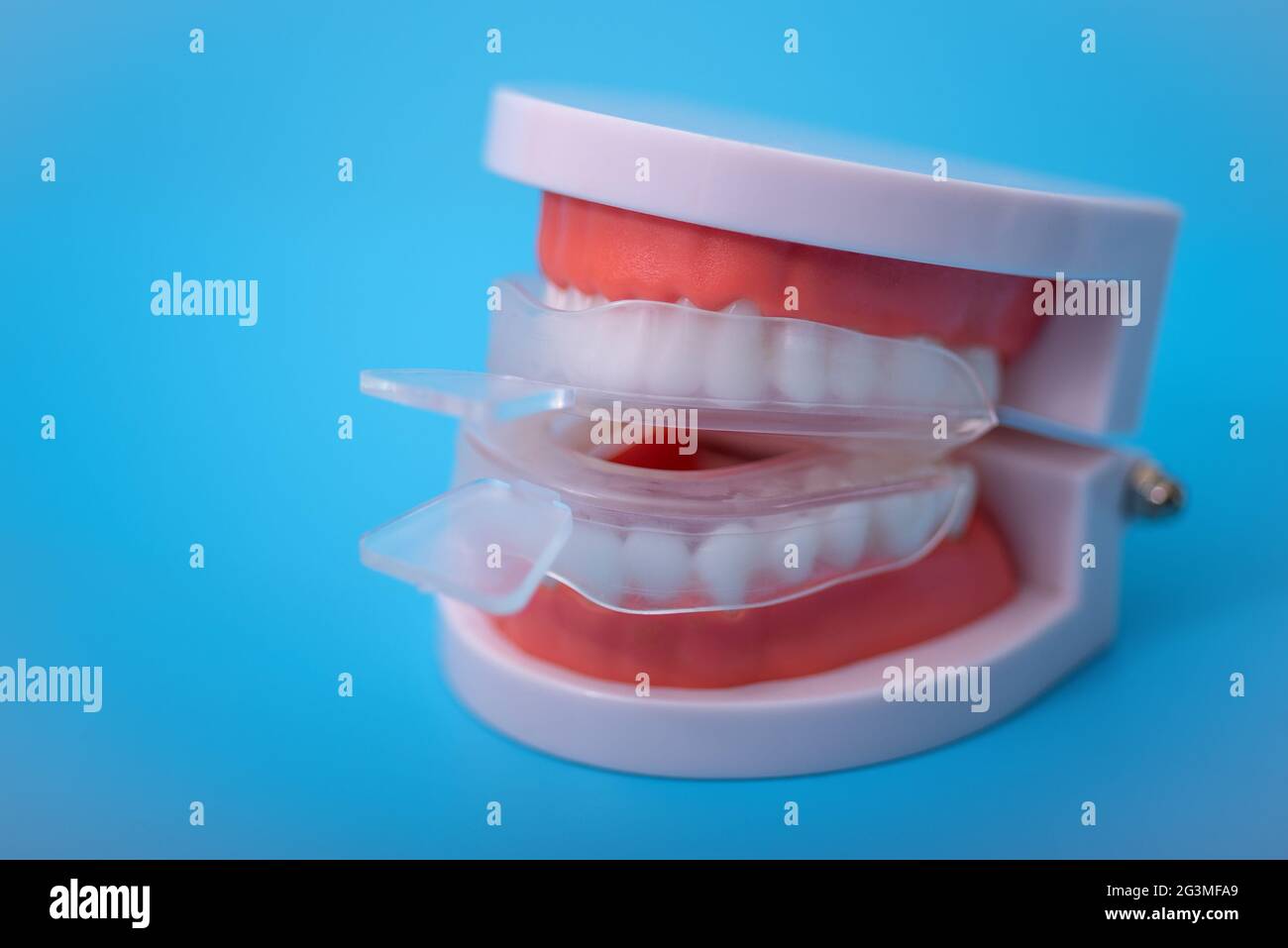 individual tooth tray for whitening and mold. imitation of a denture