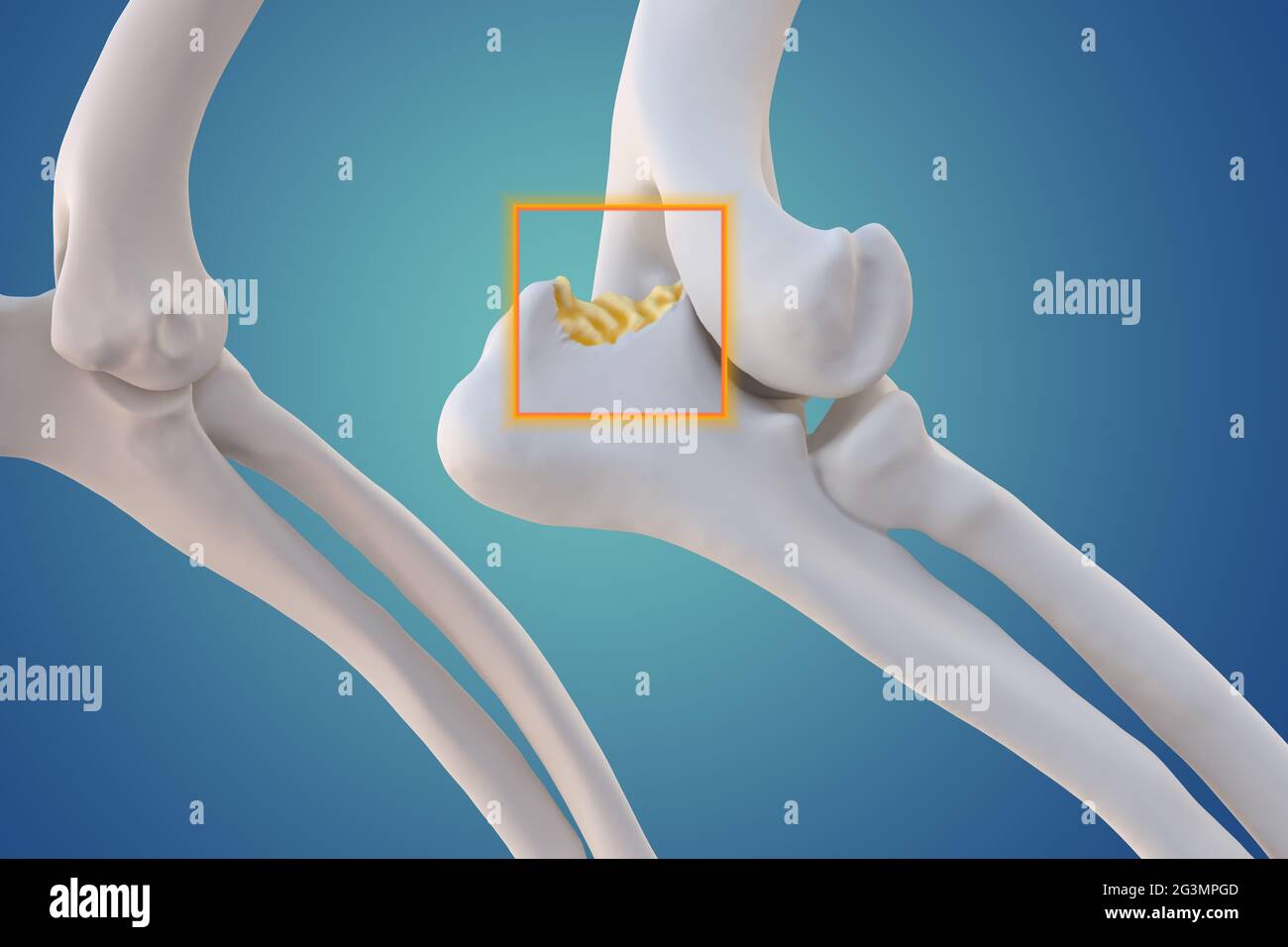 Canine Arthritis and Osteoarthritis joint inflammation, deterioration
