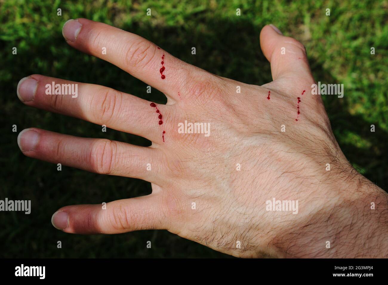 mans hand has been freshly scratched by a cat in the garden fresh blood is coming out out of the skin layer splash of blood drops on a white flower 2G3MPJ4