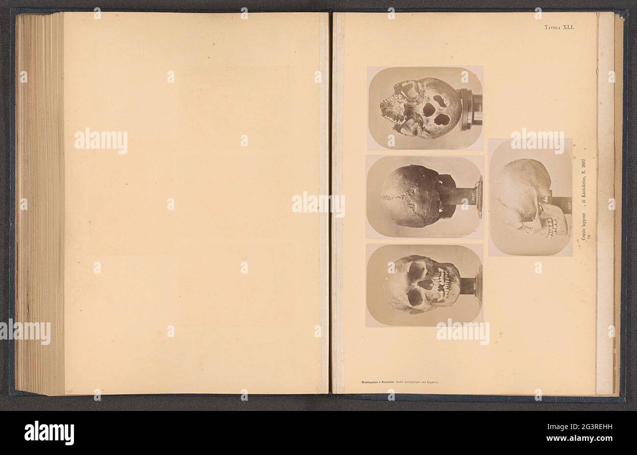 Four images of a samic skull; Cranio Lappone, di Kautokino, N. 2607. At the top left a front view, in the middle of a rear view, at the top right of a view of the bottom, under a side view. Stock Photo