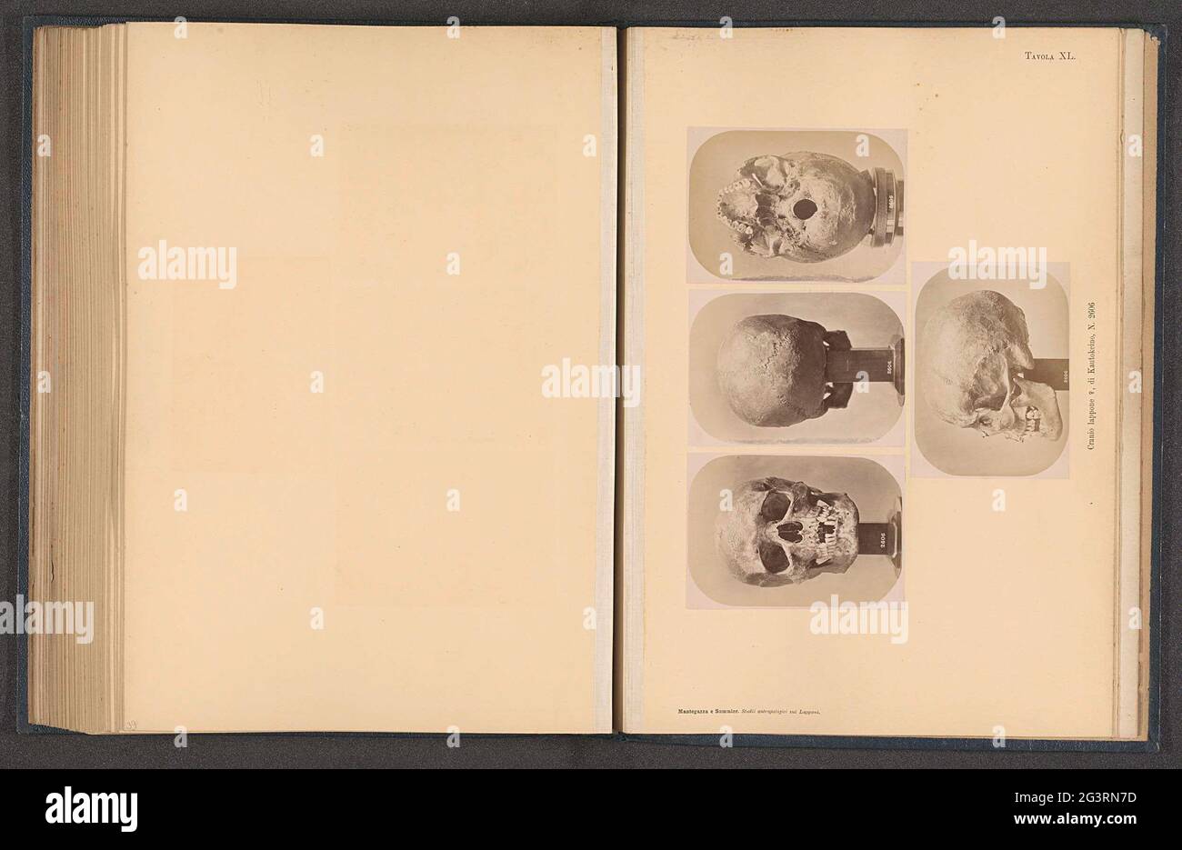 Four images of a samic woman skull; Cranio Lappone ♀, di Kautokino, N. 2606. Above a front view, at the top left of a rear view, at the top right of a view of the bottom, under a side view. Stock Photo