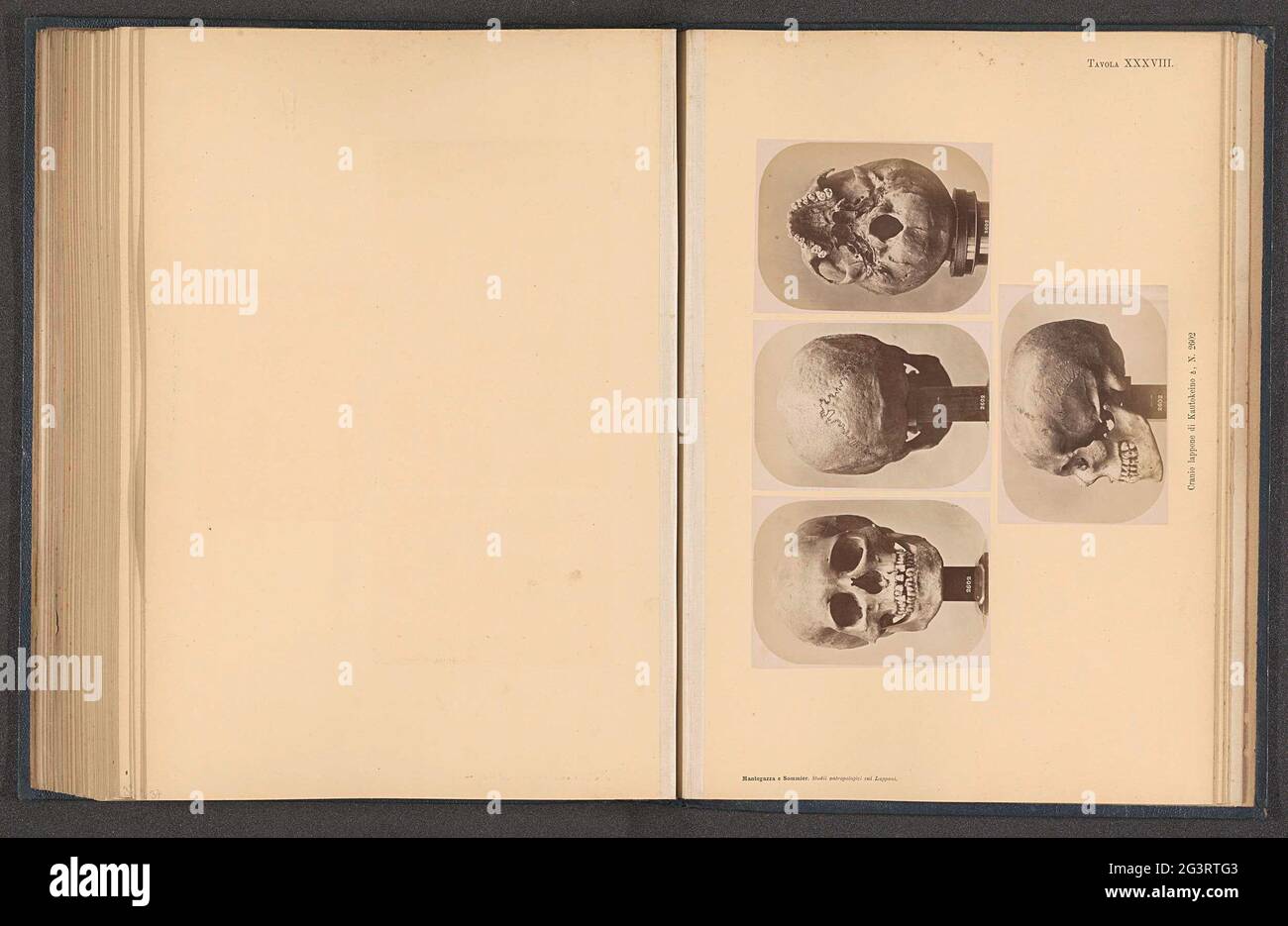 Four images of a samic men's skull; Cranio Lappone, di Kautokino ♂, N. 2602. Above a front view, at the top left, in the mid-top right, at the top right of a view of the bottom, under a side view. Stock Photo