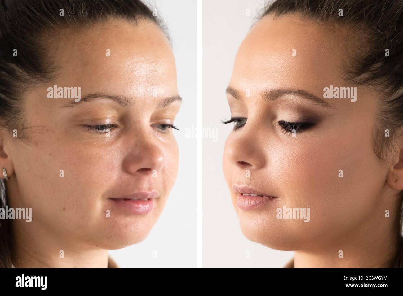 Woman Face Skin Make Up. Comparing Before And After Stock Photo