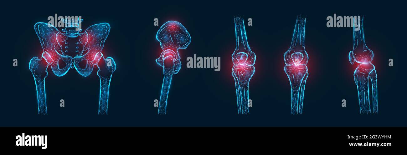 Polygonal vector illustration of pain or inflammation of the bones in the pelvis, hip joint, and knee joints isolated. Joint pai Stock Photo