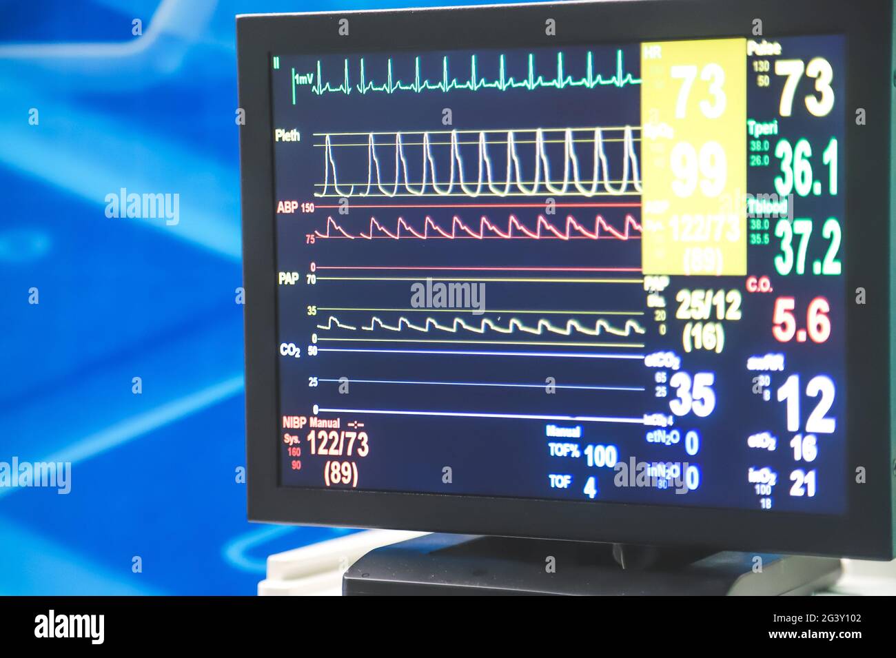 Monitoring of patientâ€™s condition and vital signs with a monitor in