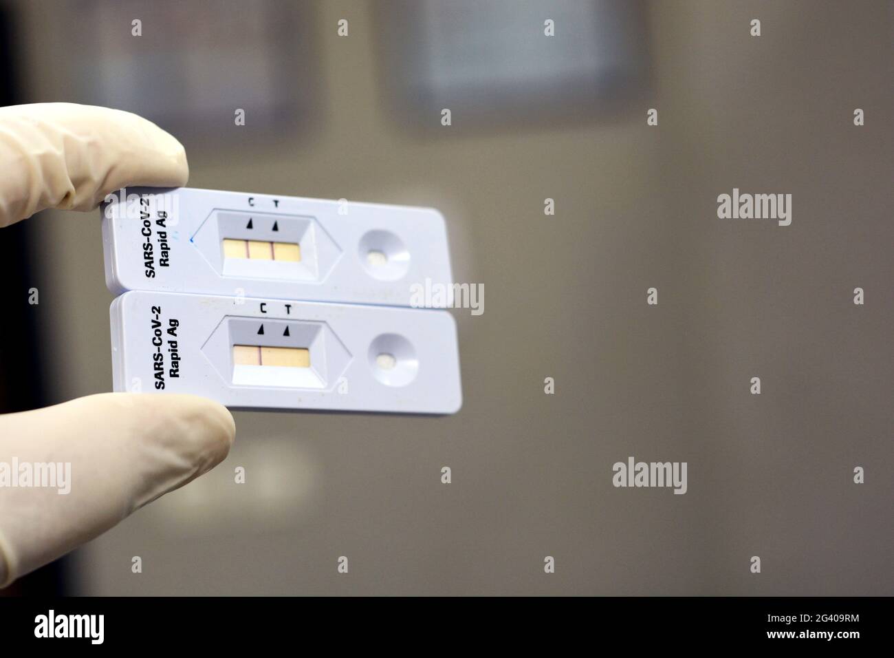 Positive and negative results of SARSCoV2 Rapid Antigen AG test done