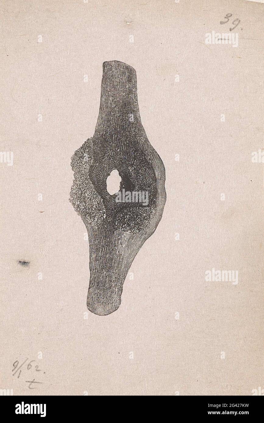 Part of the human body with a deviation Stock Photo - Alamy