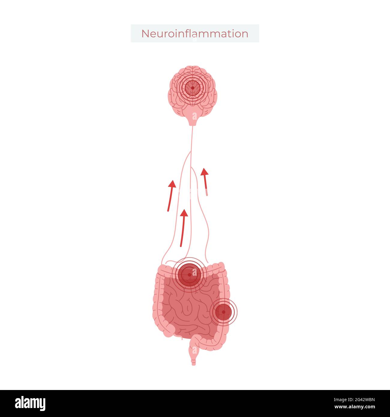 Poor gut health leads to neuroinflammation vector illustration. Stock Photo